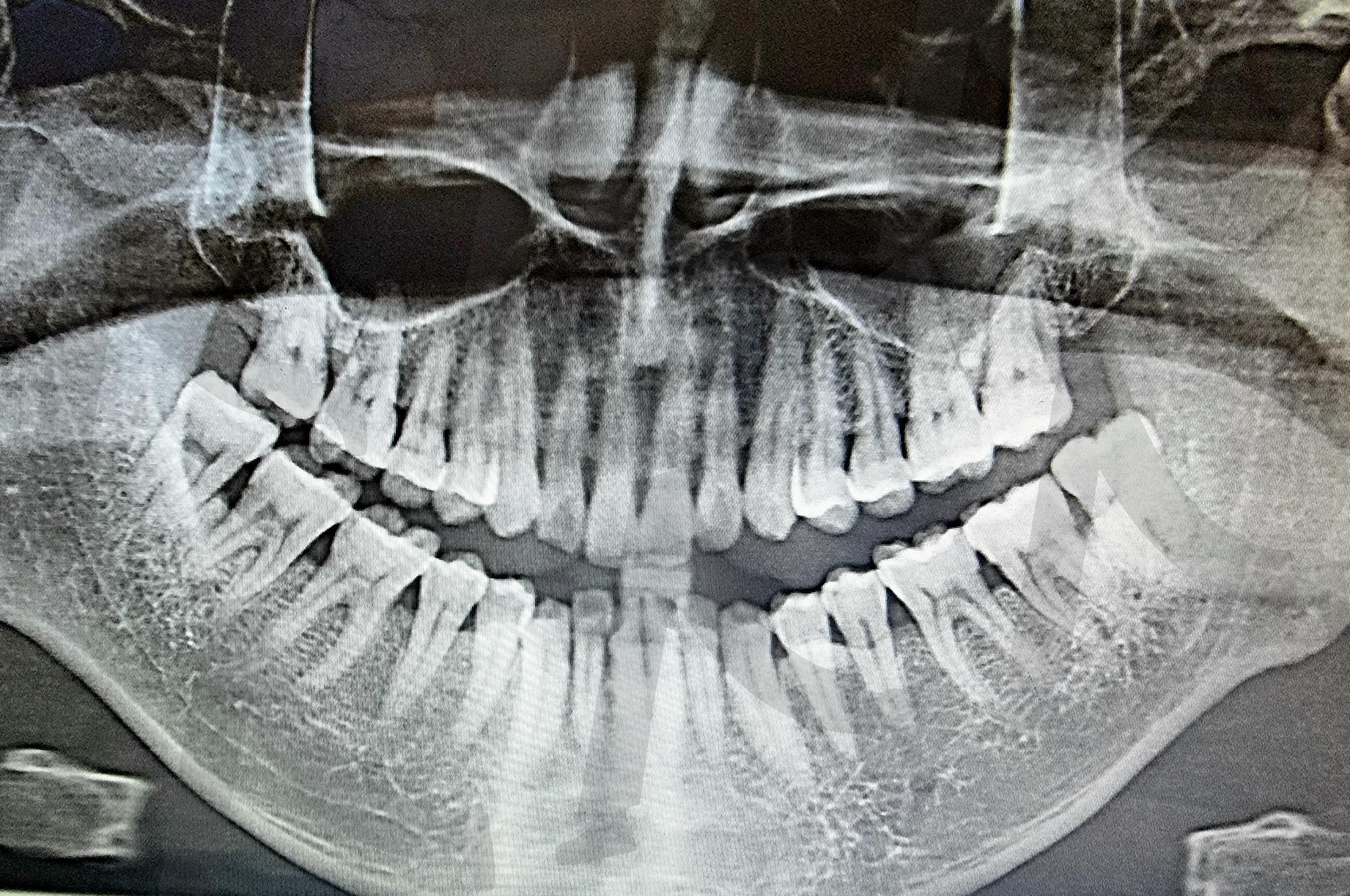 Dental X-ray – Healthy Teeth and Jaw Structure | dental X-ray, healthy teeth, oral health, dentistry, radiography, jawbone, tooth structure, dental imaging, medical diagnosis, dental care | 스탠바이 STANDBUY 디지털 콘텐츠